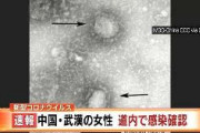 【速報】中国武漢の女性、北海道内で感染確認
