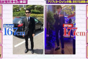 31歳イケメン医師、 “骨延長手術”で身長167cm→177cmに「モテるようになりました」費用も公開