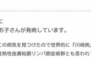 馬鹿「武漢肺炎！キャッキャw」俺「川崎病」「え？」「川崎病」