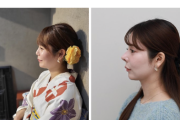 【朗報】女さん、整形で人生が変わる