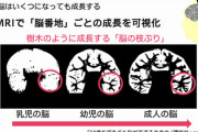 【朗報】ラジオ、脳に良いことが判明　聴き続けると記憶系脳番地が最大2.4倍に