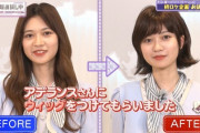 【乃木坂46】まさかの『アデランス』だったwww 寺田蘭世、超ショートカットの全貌がついに明らかに！！！！！！！！！！！！