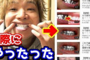 【悲報】人気の「歯を白くするマウスウォッシュ」の広告がひどすぎる…効果の根拠もウソ（画像あり）