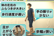 【画像】医師『”こういう歩き方”してる人、流行中の病気の予備軍かも』→