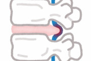 ヘルニア、あまりにも地獄