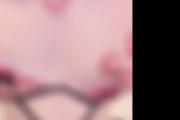 【動画】ひなこノート作者、チ首イキしながら自らの病気について語る