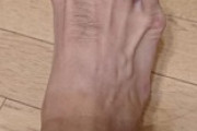 ワイ、足の形がなんかおかしい（※画像あり）