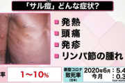 【悲報】致死率1～10％の「サル痘」、東京で感染が確認される。これ大丈夫なんか？