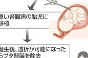 重い腎臓病の胎児にブタの腎臓移植、東京慈恵医大が学内審査へ…世界的に注目の「異種移植」