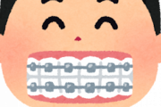 学生の間に歯矯正してもらえなかった奴wwwwwwwwww