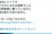 【悲報】女さん、男が「AED」で助けた場合やっぱり訴えてくる可能性がある模様ｗｗｗｗｗｗｗ