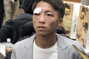 【悲報】井上尚弥、目と鼻を骨折していた