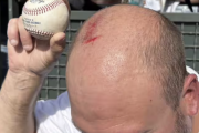 大谷の55号HR球をキャッチした男性、手すりに頭頂部をぶつけて出血