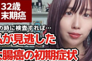 32歳美人YouTuber「痔だと思って放置してたらステージ4の大腸がん」