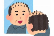 朗報！抜けさせないのでハゲないという画期的な発毛法を発見か！