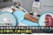 豚の腎臓を脳死状態の人に移植成功 NY  [10/21]