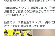 【衝撃】人気ユーチューバー、骨延長手術wｗｗｗ