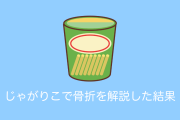日本人が「じゃがりこ」で骨折を解説した結果→めちゃくちゃ分かりやすい！【台湾人の反応】