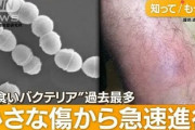 【緊急】医師「人食いバクテリア急増の件、”本当にヤバい事実”がこれ…」