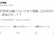 声優・鬼頭明里さん、口内炎が10個もできてしまう