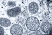 WHO「サル痘という名称は良くないので『エム痘(mpox)』に変えます！」