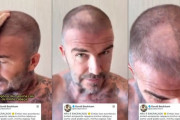 ◆悲報◆デイビッド・ベッカムさん散髪失敗して特大のハゲが出来てしまう😭