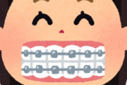 27歳女が歯列矯正て…