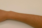 【画像】脱毛処理してない女さんの腕がこちらｗｗｗ