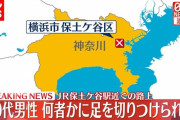 「男とすれ違ったとき足に痛み」 路上で男性が足を何者かに切りつけられる