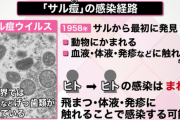 NY　サル痘感染拡大　LGBTQが多い地域で