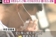 【東京】目黒区の路上で女性からバッグを奪いけがをさせた疑い　慶大生2人逮捕