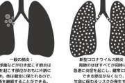 「ぬー、ぬー」←20分後に死亡　『自宅療養』は『必要悪』？【新型コロナ】