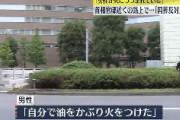 【焼身自殺未遂】「私個人は国葬に断固反対」の手書きメモも　自称70代の男