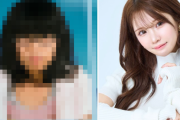 グラビアアイドルさんの整形ビフォーアフター画像が凄いと話題に