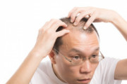 薄毛にストレスも食生活も無関係。20代で薄毛の人と60でもドふさな人の差はこれ