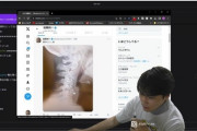 【唖然】YouTuber加藤純一、医師も驚く首の異常が判明 「ぎっくり首」「筋膜炎」「ヘルニア」の三重苦