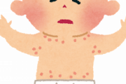 【画像※ｶﾞﾁ閲注】ぉケツのあせもってどうやって治すんだよ…(´・ω:;.:...