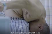 中国の『折り畳まれた男』リー・フアさんが28年ぶりにまっすぐ立つことに成功