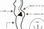 ALS患者「筋肉がどんどん衰えます」←いや、筋トレすればいいよね？