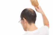 「くせ毛・薄毛犠牲者」フランス、頭髪差別を法律で禁止へ