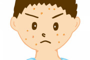 【悲報】皮膚科「ニキビは潰さないでください」思春期ワイ「うっせーw（ブチッ）」→結果・・・
