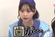 黄色い歯をイジられる春日まとめ【日向坂46】