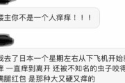 中国人「日本に行ったらずっと全身痒かった、中国に戻ったら治った。もう二度と行きたくないと思ったけど、周りの友人はみんな『また日本へ行きたい』と言っている」　中国の反応
