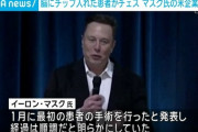 イーロン・マスク、脳に小型チップを入れた患者がチェスをする様子を公開　「画面を見つめるだけでカーソルが動く」
