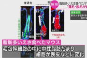 【ハゲ速報】脂肪の多い食べ物を食べると薄毛や脱毛の症状が進む…東京大学等の研究グループがネイチャーで発表