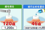 「麻酔治療が必要なむし歯は1本もなかった」司法解剖した医師が証言　死亡した2歳女児　背景に過剰治療か