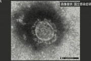 【コロナ】武漢ウイルス 感染後の抗体 数か月後に減少　半数の人で70％超減少　中国研究グループ