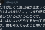 【悲報】骨延長の人、遂に『覚悟』を決め始める。こんなの酷すぎるやろ…