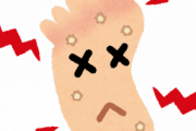 【画像】ワイの足に謎のブツブツができるｗｗｗ