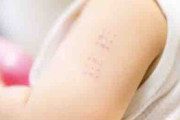 なんｊ腕にBCGの跡が見当たらない部